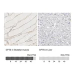Atlas Antibodies Anti-SPTB Antibody