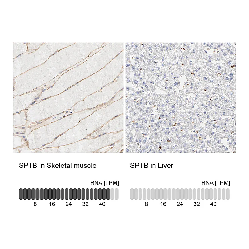 Atlas Antibodies Anti-SPTB Antibody