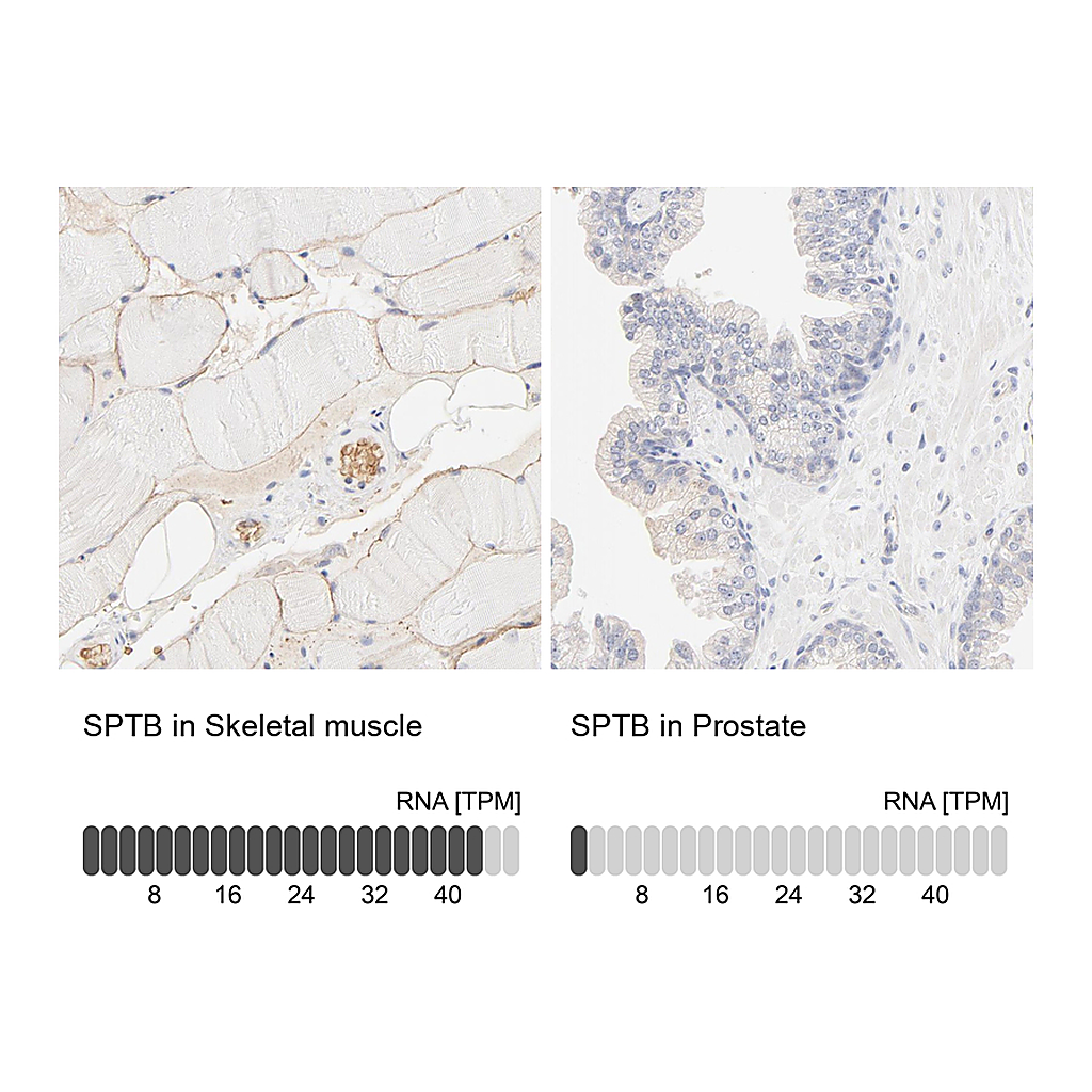 Atlas Antibodies Anti-SPTB Antibody