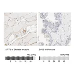 Atlas Antibodies Anti-SPTB Antibody