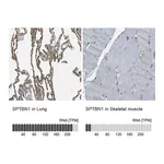 Atlas Antibodies Anti-SPTBN1 Antibody