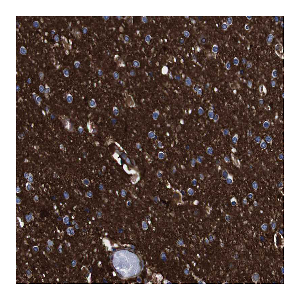 Atlas Antibodies Anti-SPTBN1 Antibody