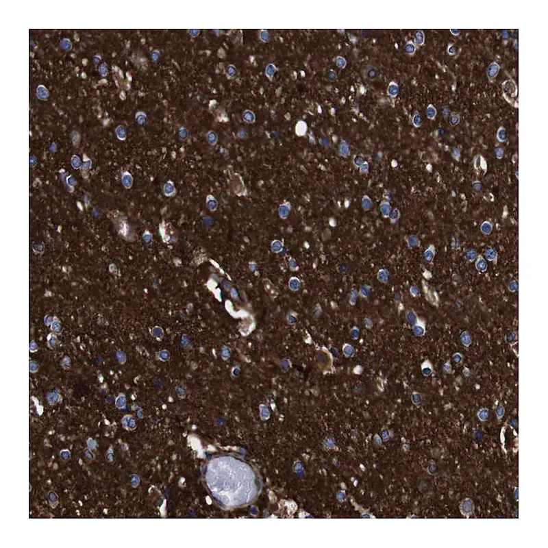 Atlas Antibodies Anti-SPTBN1 Antibody