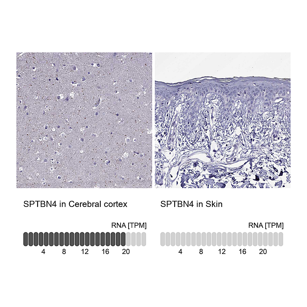 Atlas Antibodies Anti-SPTBN4 Antibody