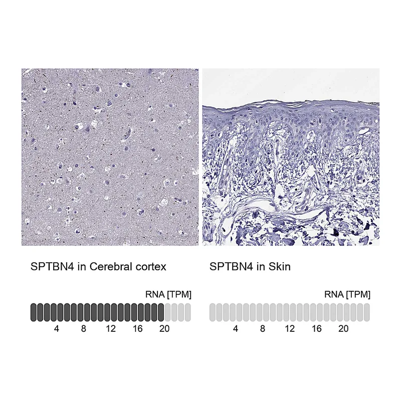 Atlas Antibodies Anti-SPTBN4 Antibody