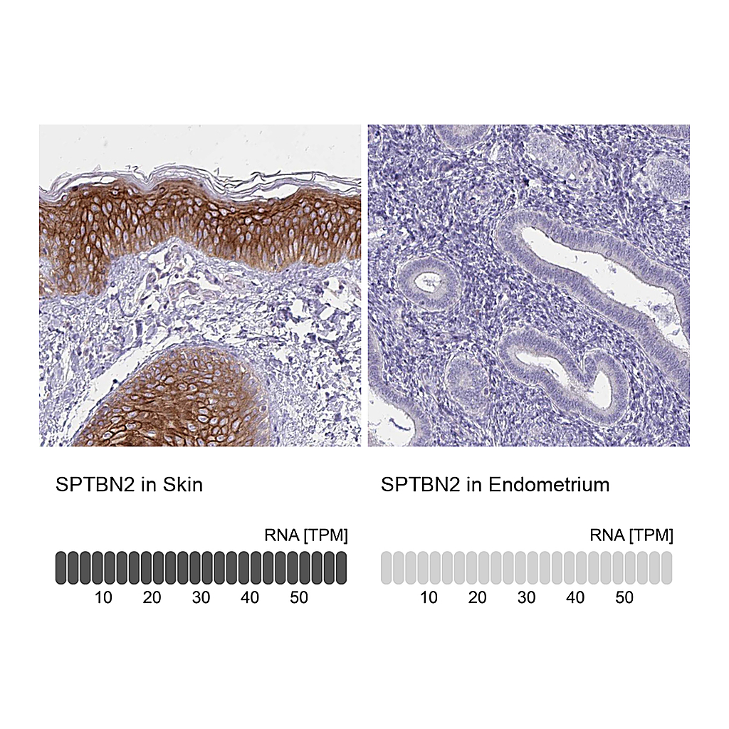 Atlas Antibodies Anti-SPTBN2 Antibody