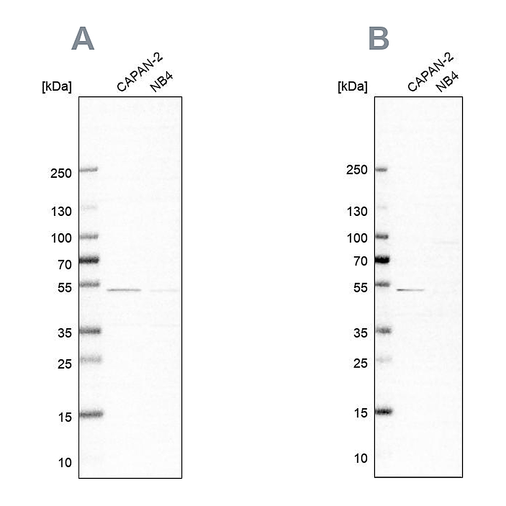 Atlas Antibodies Anti-SPTLC1 Antibody