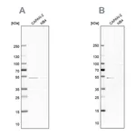 Atlas Antibodies Anti-SPTLC1 Antibody