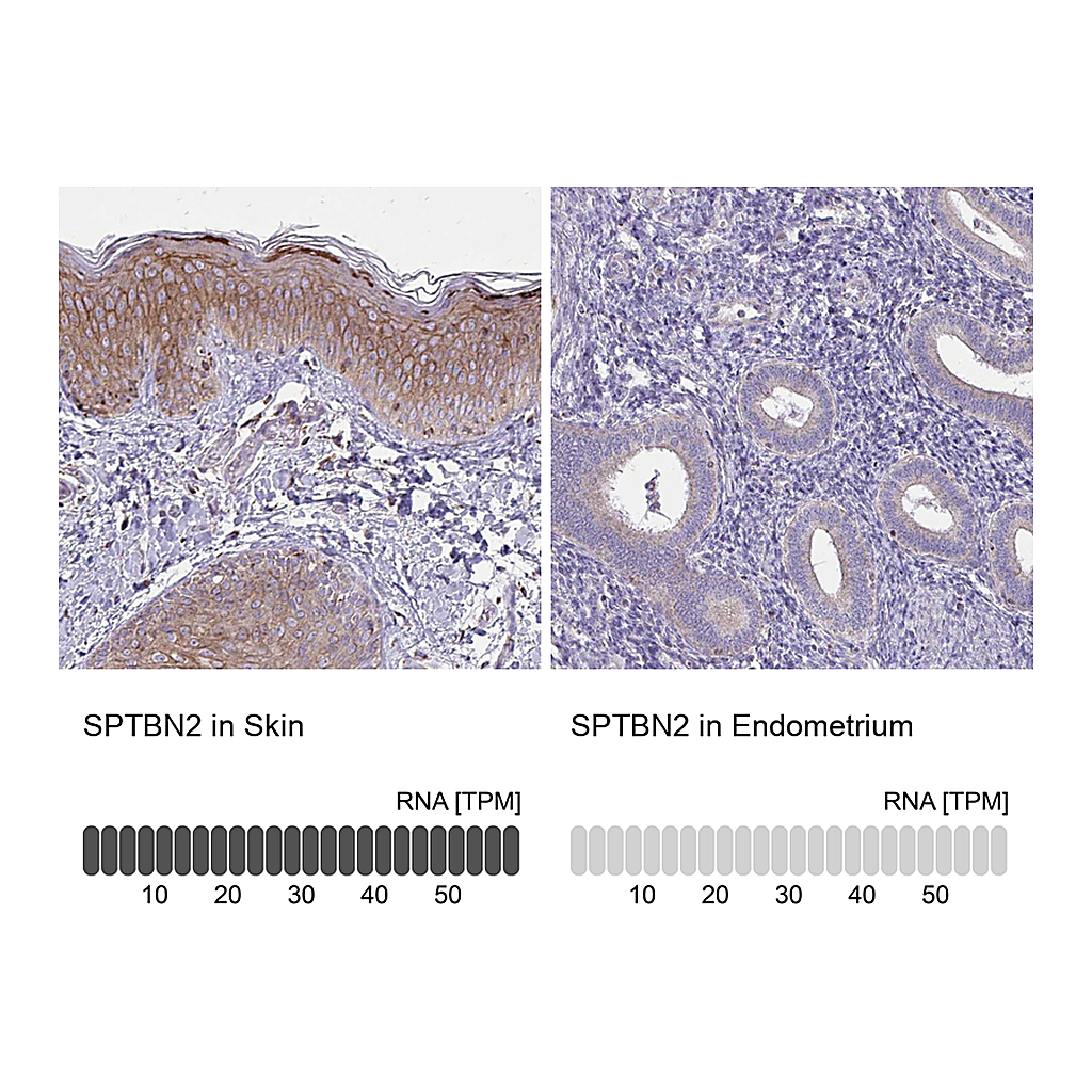 Atlas Antibodies Anti-SPTBN2 Antibody