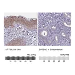 Atlas Antibodies Anti-SPTBN2 Antibody