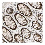 Atlas Antibodies Anti-SPTLC1 Antibody