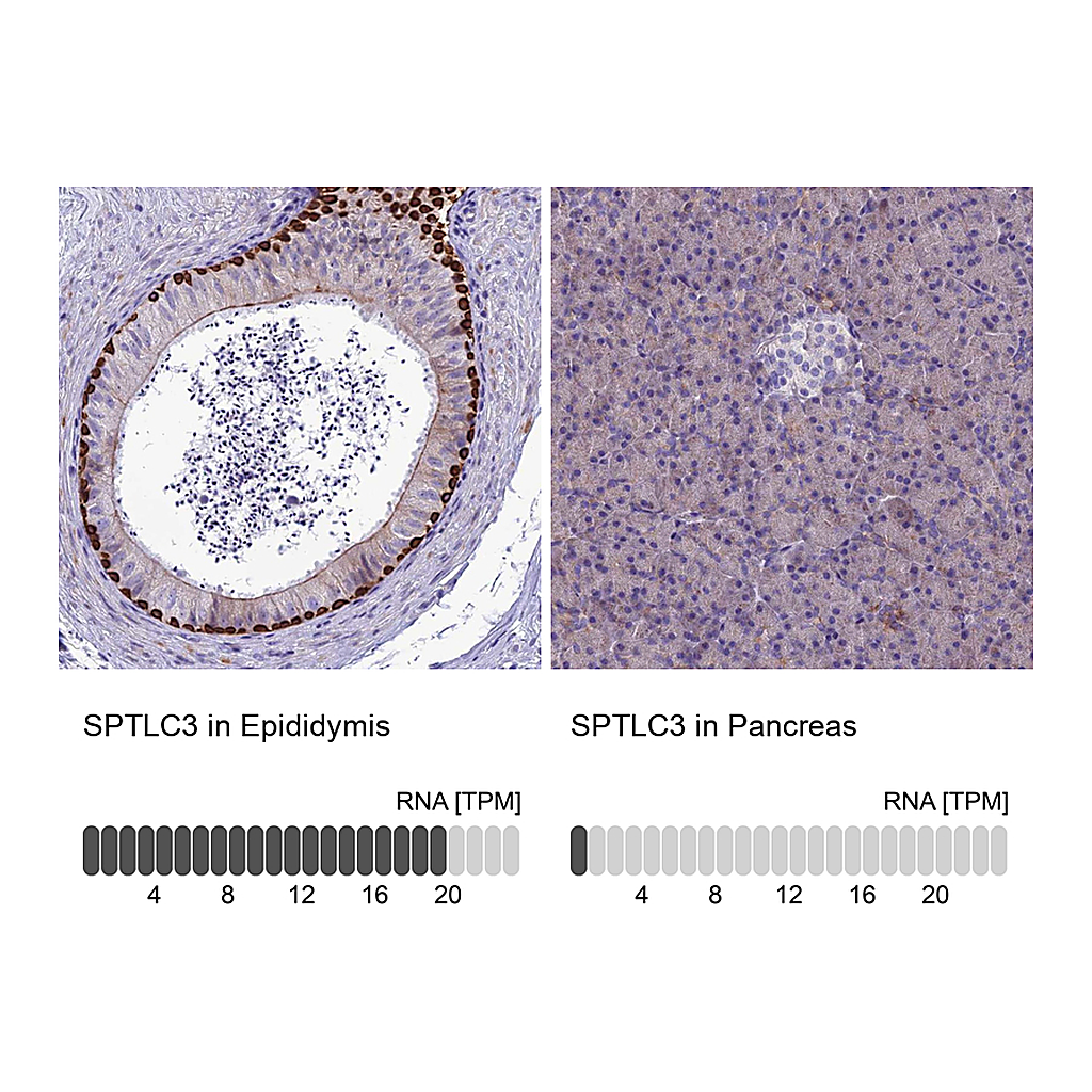 Atlas Antibodies Anti-SPTLC3 Antibody