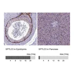 Atlas Antibodies Anti-SPTLC3 Antibody