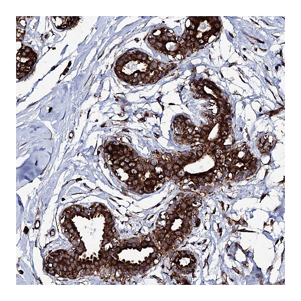 Atlas Antibodies Anti-SPTY2D1 Antibody