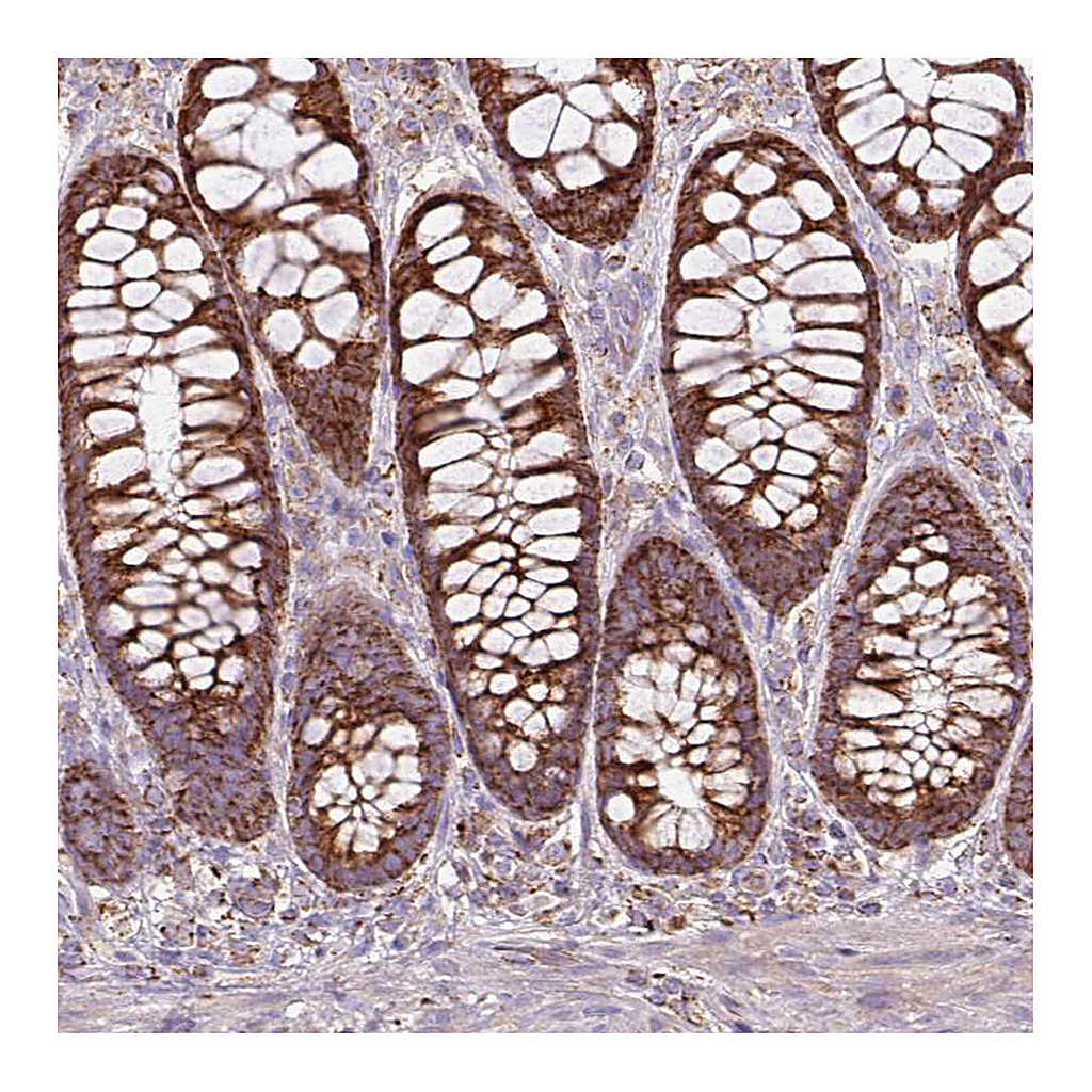 Atlas Antibodies Anti-SQRDL Antibody