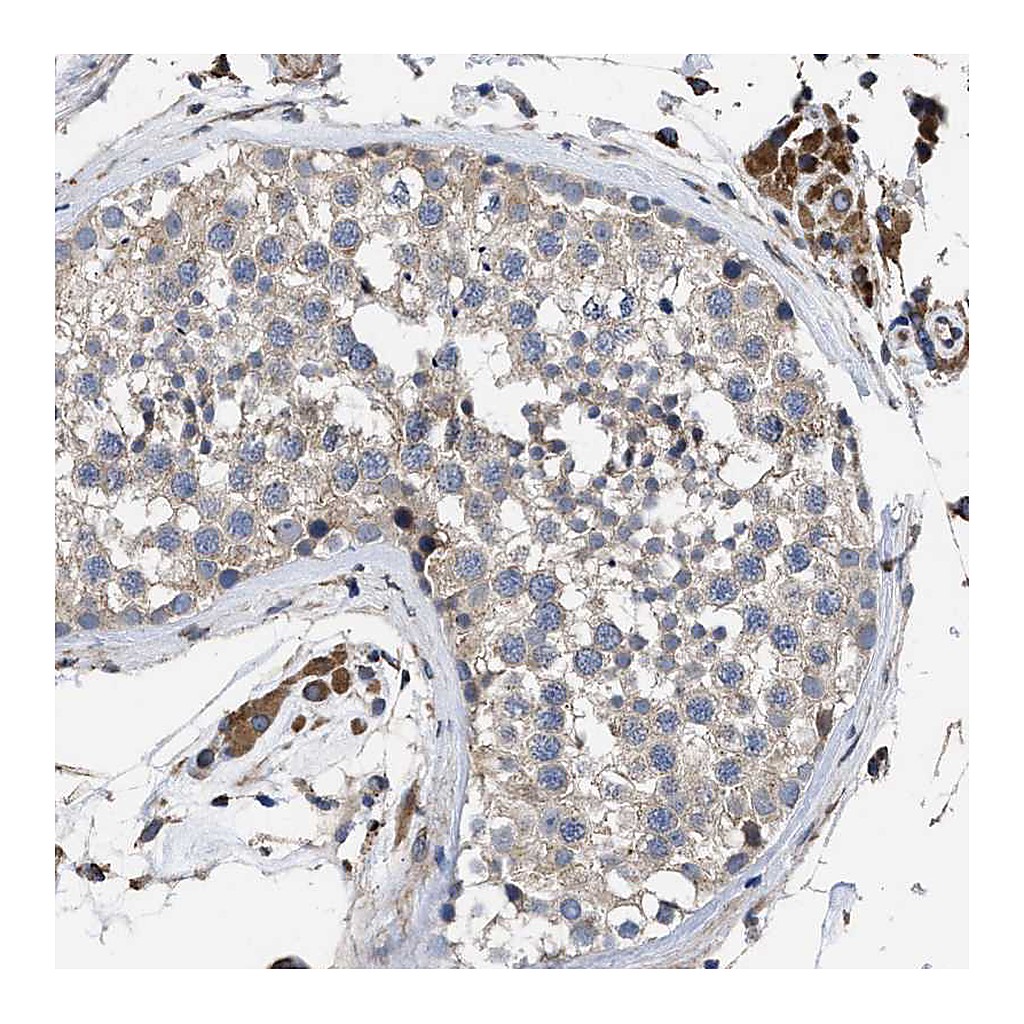 Atlas Antibodies Anti-SQLE Antibody