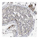 Atlas Antibodies Anti-SQLE Antibody