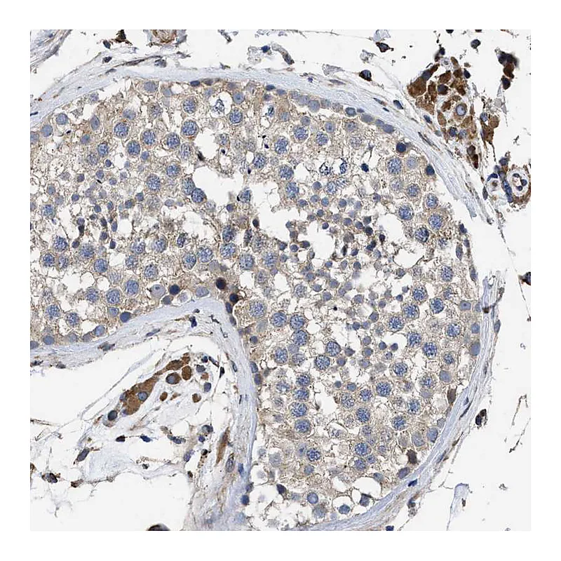 Atlas Antibodies Anti-SQLE Antibody