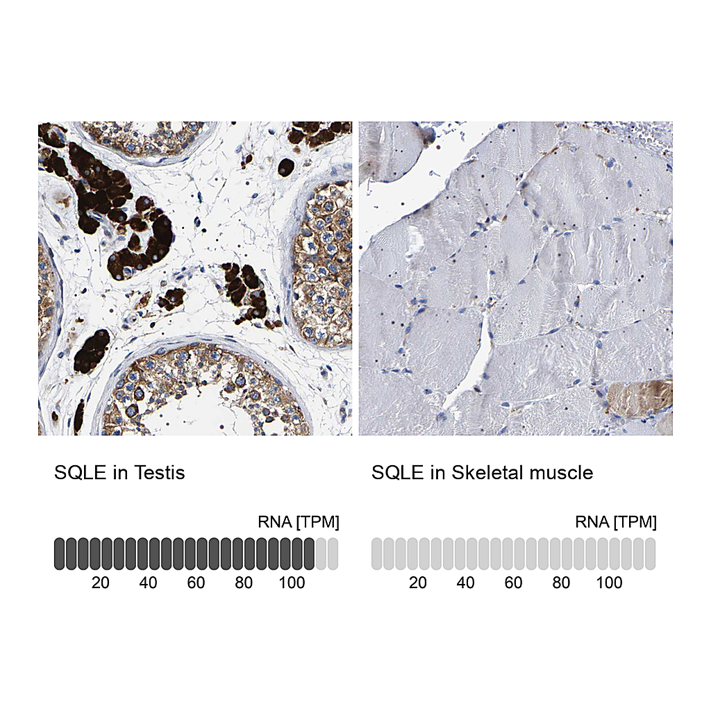Atlas Antibodies Anti-SQLE Antibody