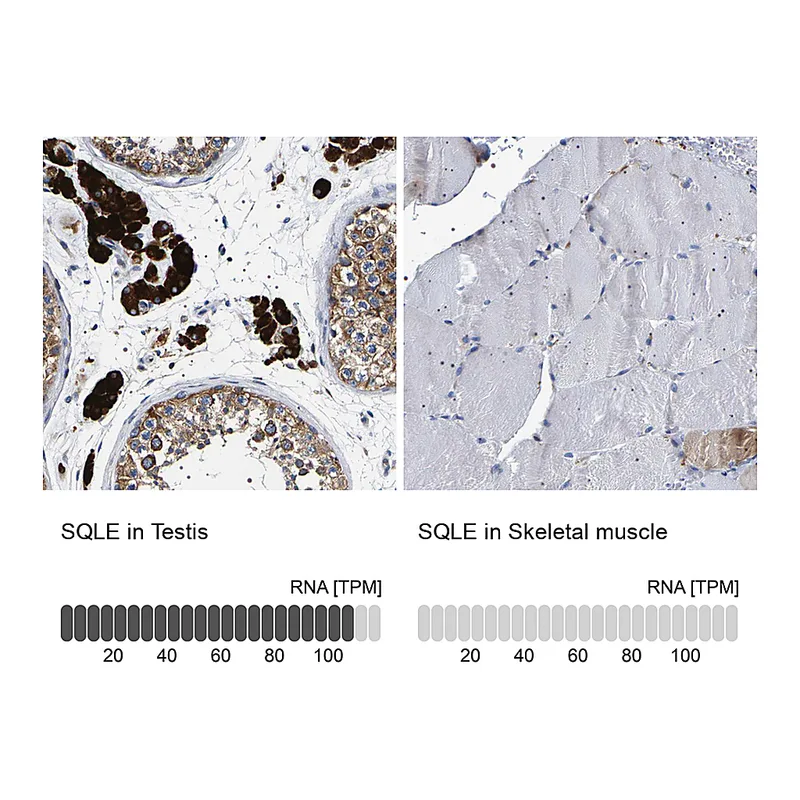 Atlas Antibodies Anti-SQLE Antibody