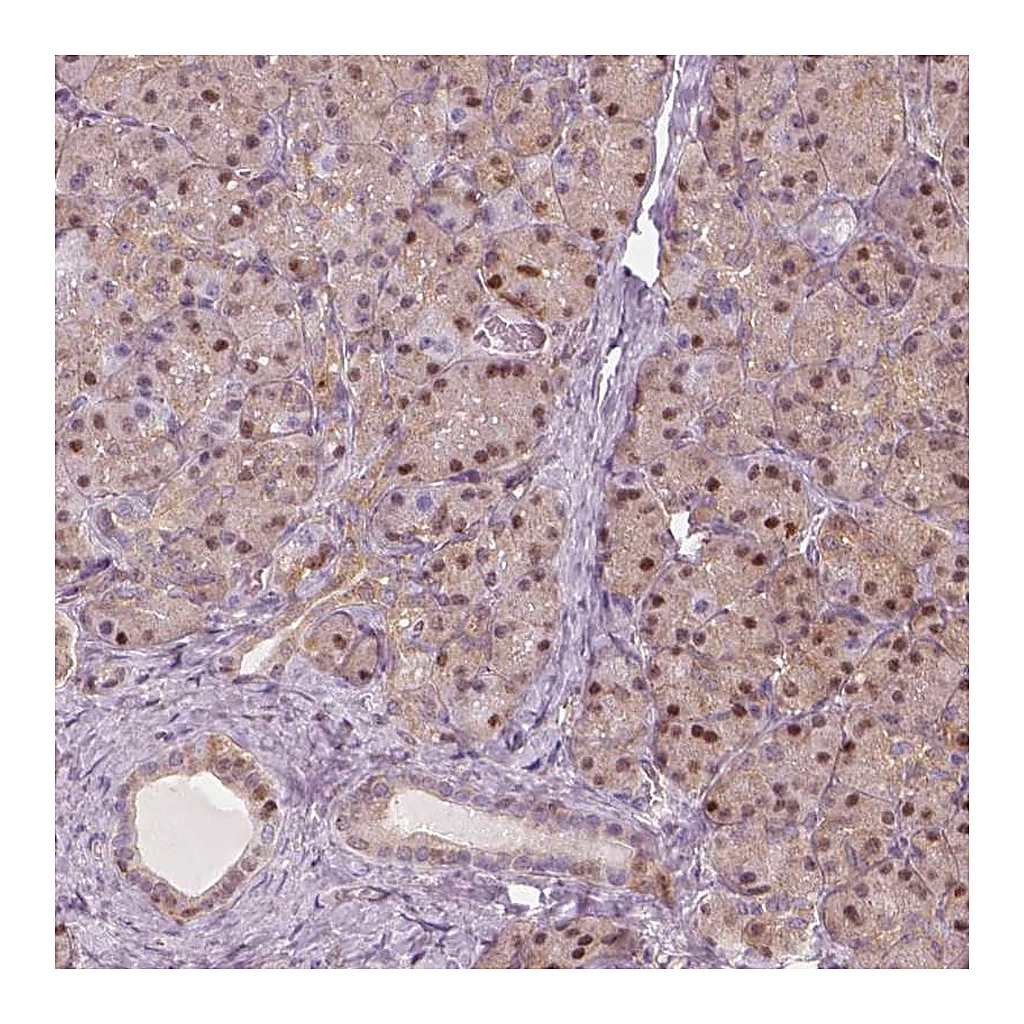 Atlas Antibodies Anti-SQSTM1 Antibody