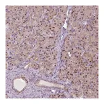 Atlas Antibodies Anti-SQSTM1 Antibody