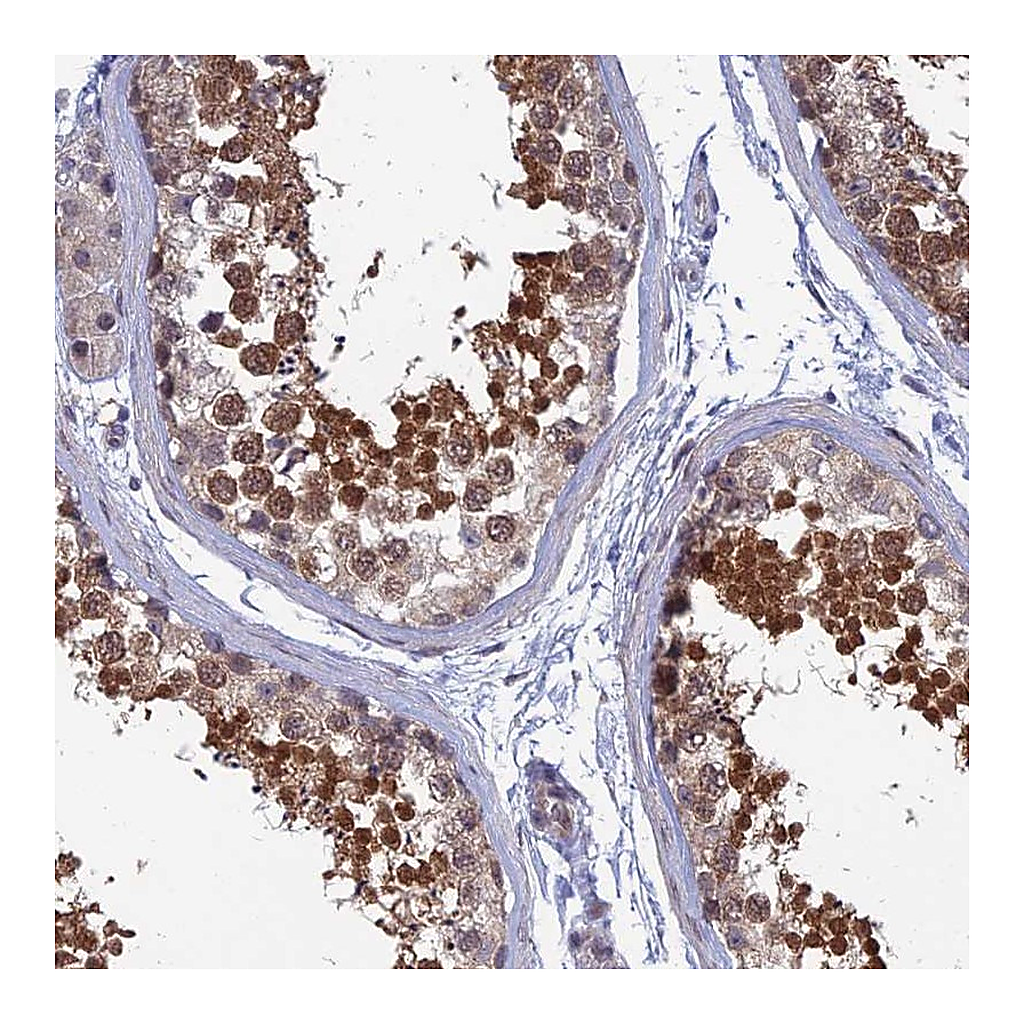 Atlas Antibodies Anti-SRA1 Antibody