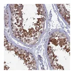 Atlas Antibodies Anti-SRA1 Antibody