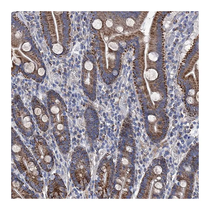 Atlas Antibodies Anti-SRBD1 Antibody