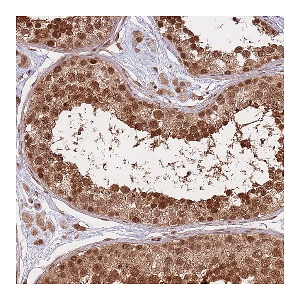 Atlas Antibodies Anti-SRA1 Antibody