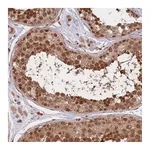 Atlas Antibodies Anti-SRA1 Antibody