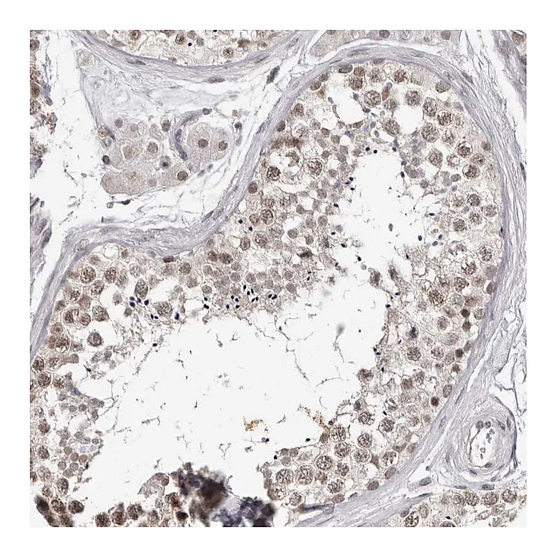 Atlas Antibodies Anti-SRCAP Antibody