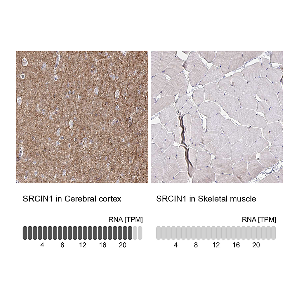 Atlas Antibodies Anti-SRCIN1 Antibody