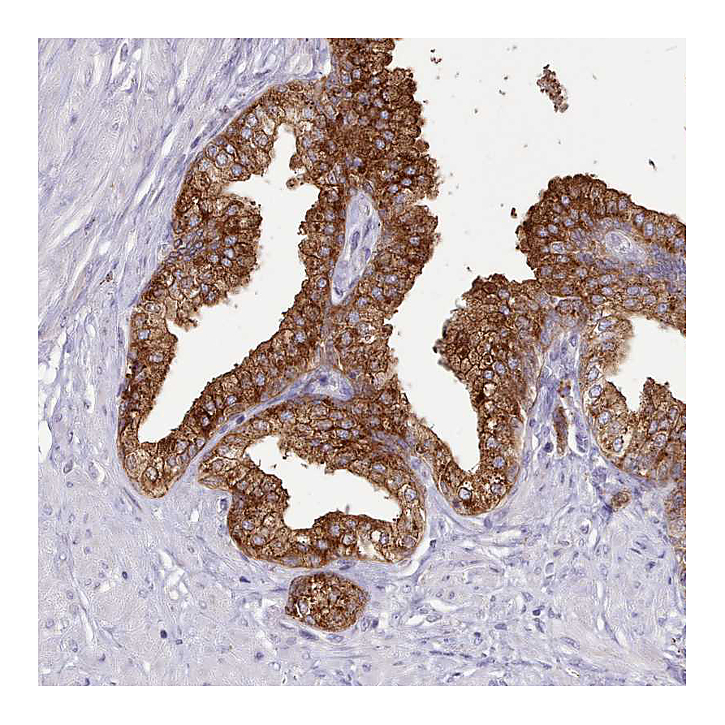 Atlas Antibodies Anti-SRD5A1 Antibody