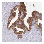 Atlas Antibodies Anti-SRD5A1 Antibody