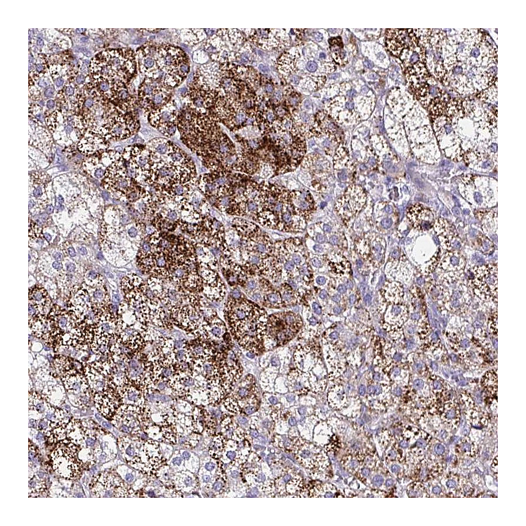 Atlas Antibodies Anti-SREBF1 Antibody