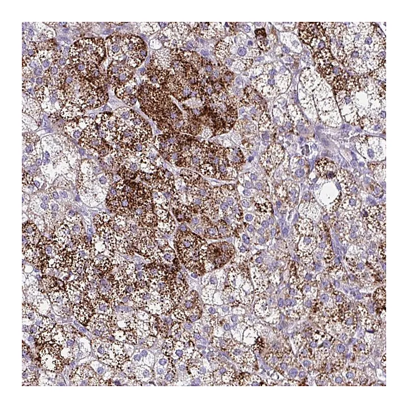 Atlas Antibodies Anti-SREBF1 Antibody