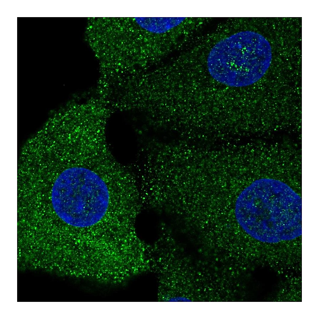 Atlas Antibodies Anti-SREBF1 Antibody