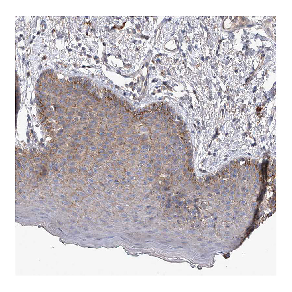 Atlas Antibodies Anti-SRD5A3 Antibody
