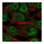 Atlas Antibodies Anti-SREBF2 Antibody