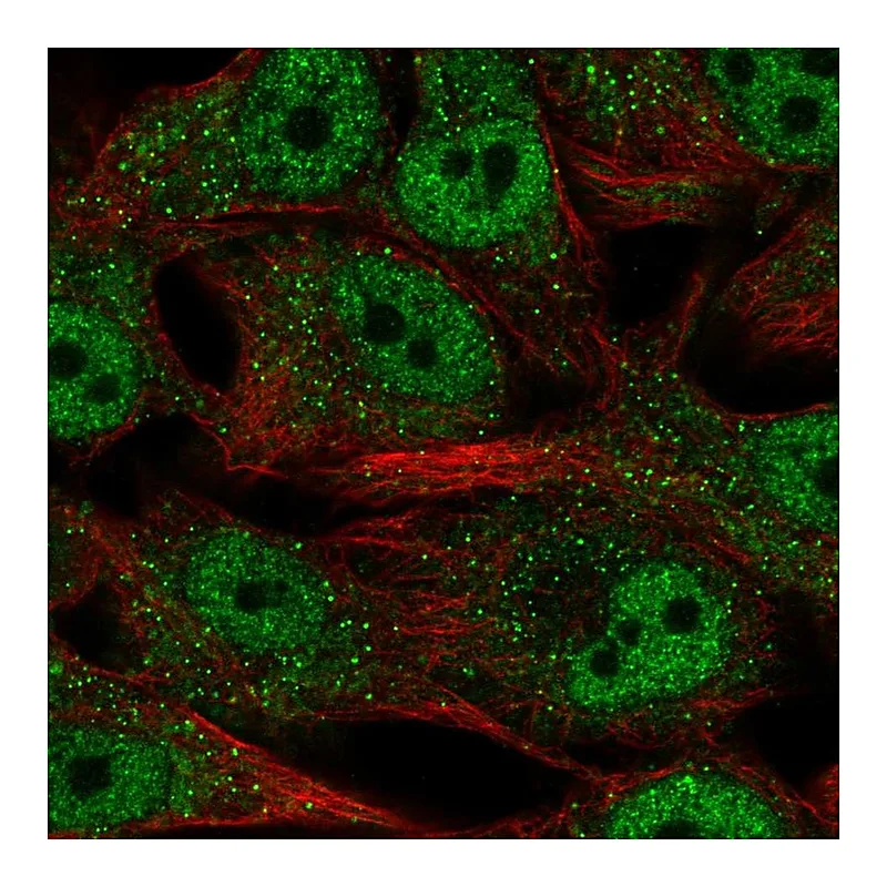 Atlas Antibodies Anti-SREBF2 Antibody