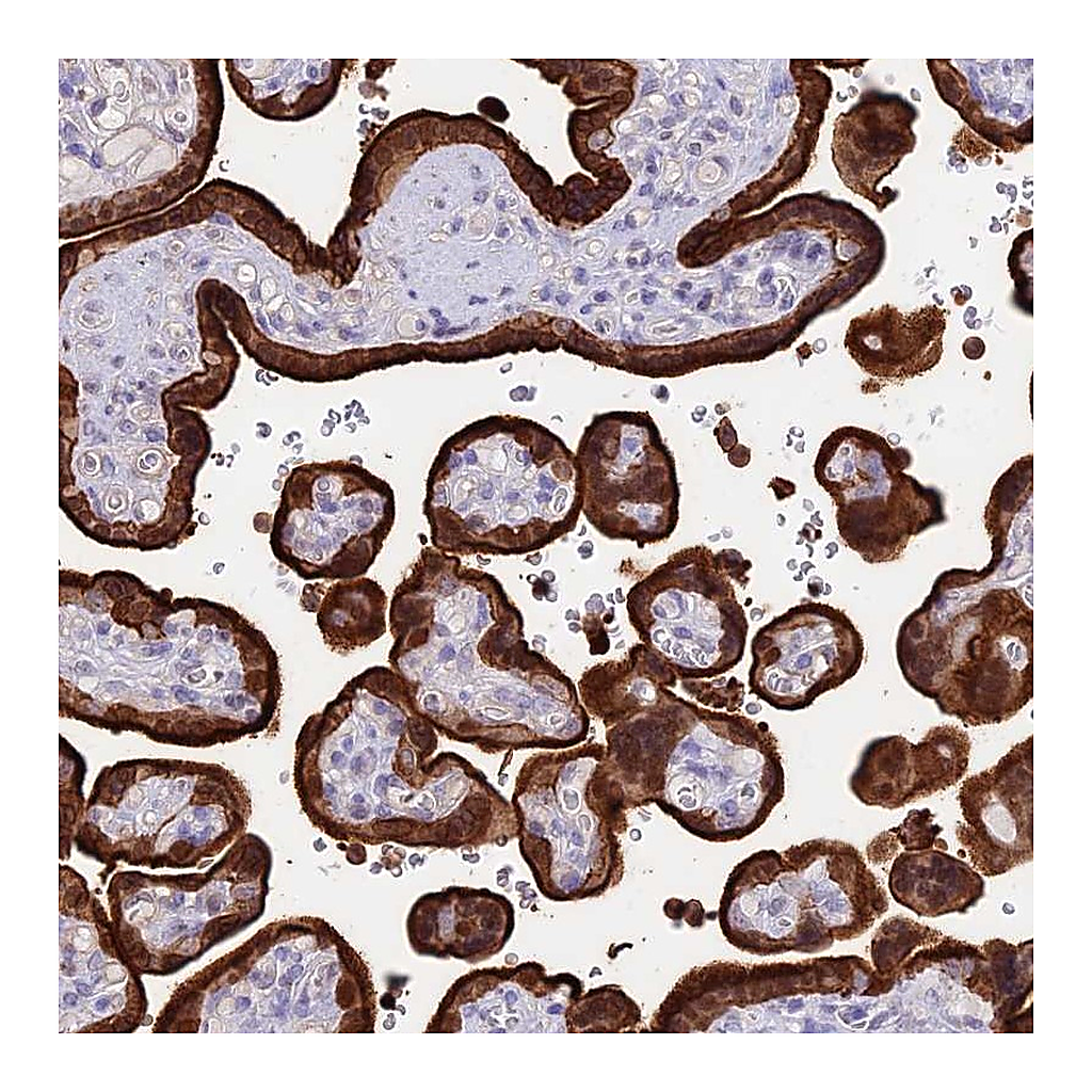 Atlas Antibodies Anti-SREK1IP1 Antibody