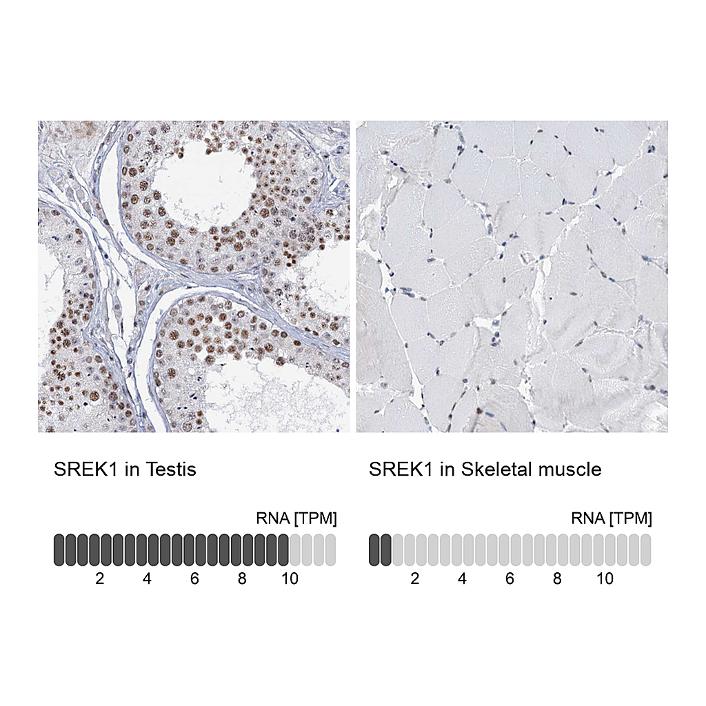 Atlas Antibodies Anti-SREK1 Antibody