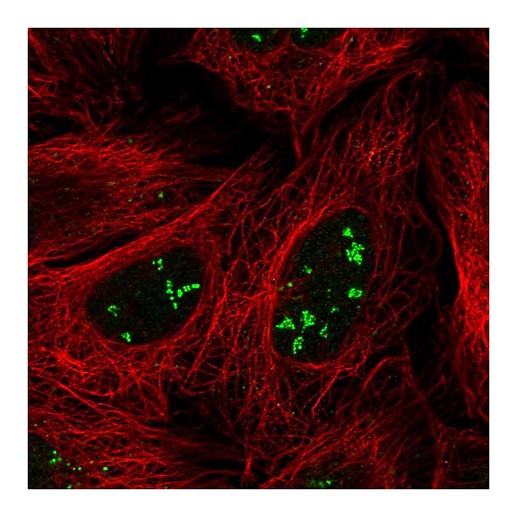 Atlas Antibodies Anti-SRFBP1 Antibody