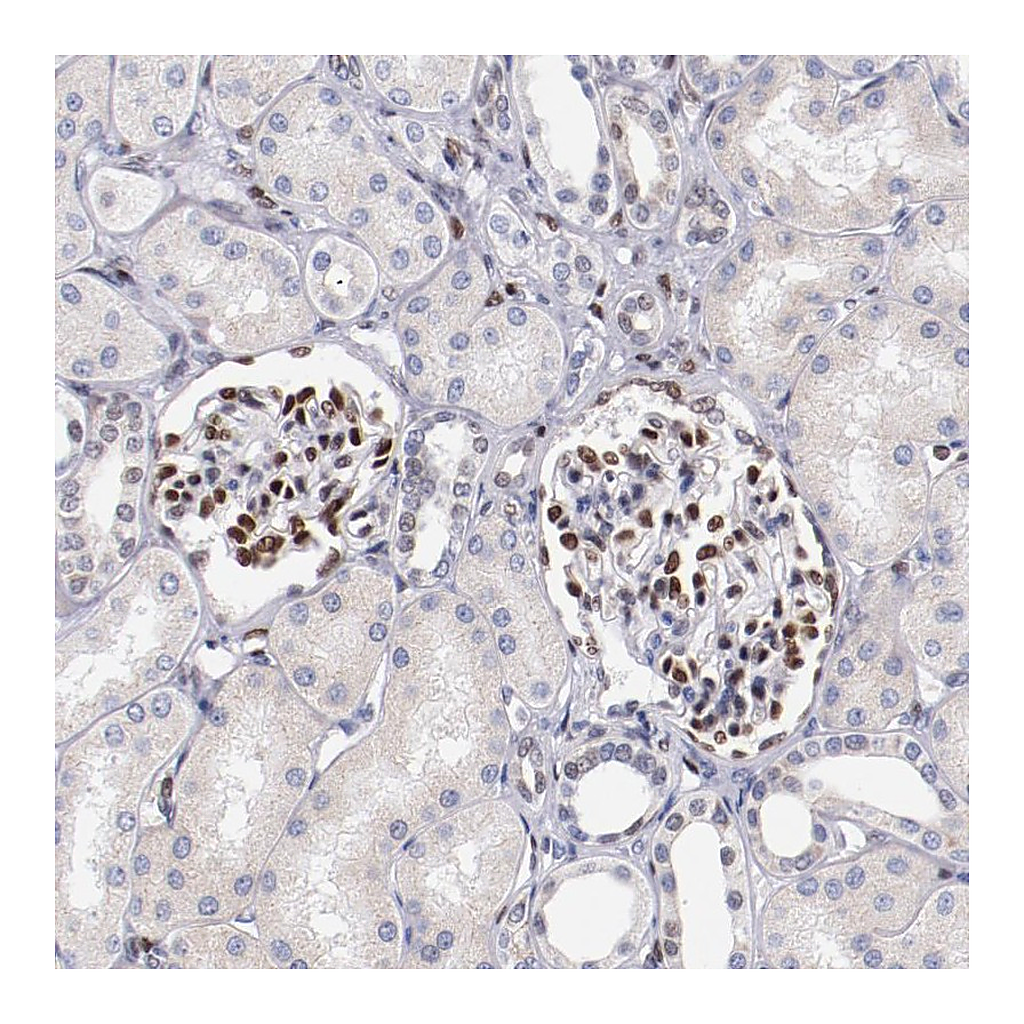 Atlas Antibodies Anti-SRF Antibody