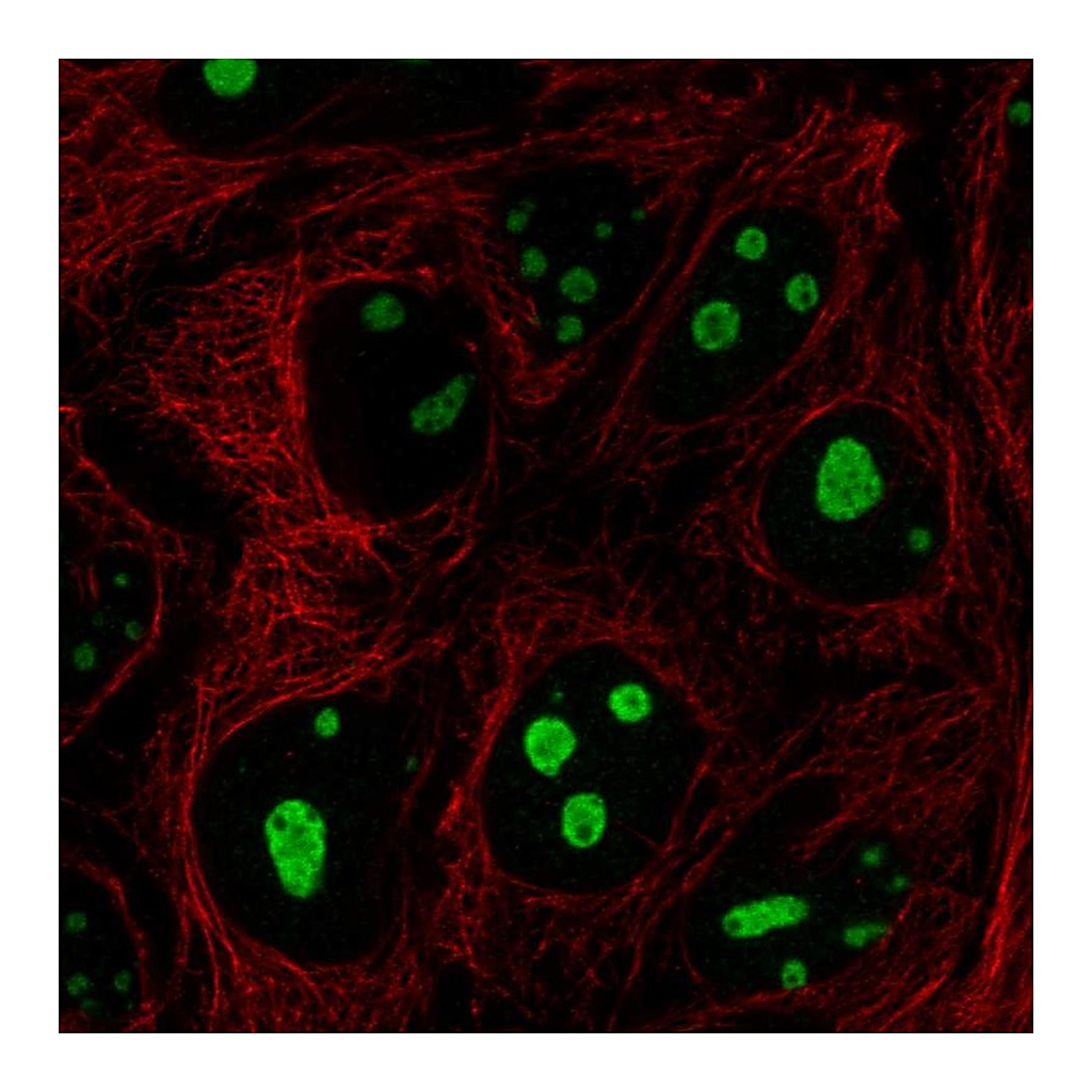 Atlas Antibodies Anti-SREK1IP1 Antibody