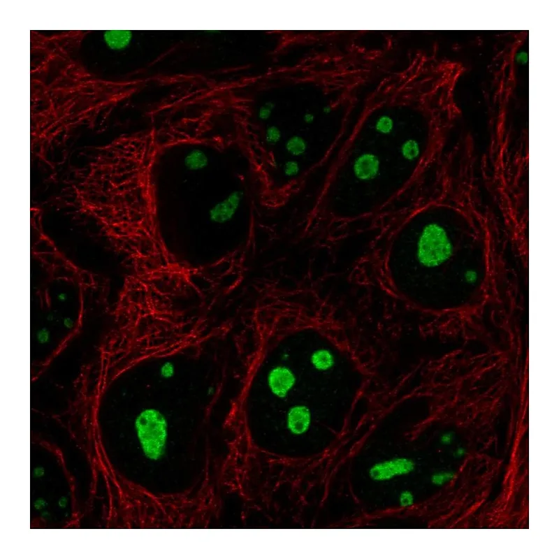 Atlas Antibodies Anti-SREK1IP1 Antibody