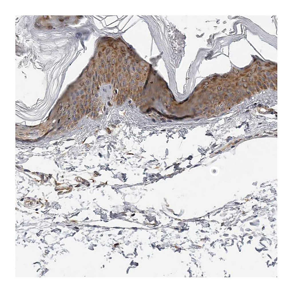 Atlas Antibodies Anti-SRGAP2 Antibody