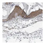 Atlas Antibodies Anti-SRGAP2 Antibody