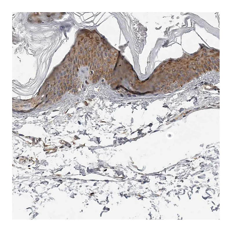 Atlas Antibodies Anti-SRGAP2 Antibody